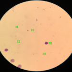 A sample of the annotated image( green box represent a plasmodium)