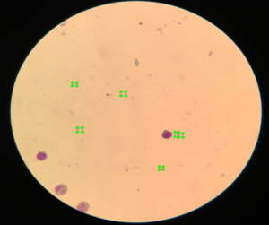 A sample of the annotated image( green box represent a plasmodium)